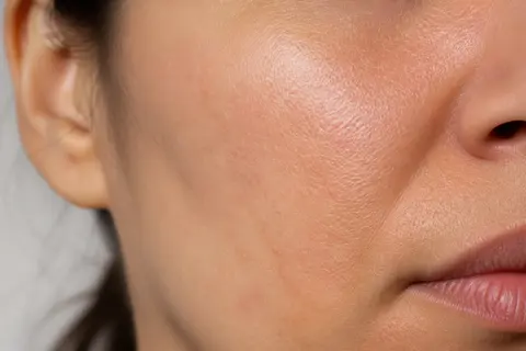 Minh họa cho “Mức chi tiết da”: high-fidelity skin detail without beauty smoothing.